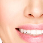 Veneers correct a number of problems with smiles.