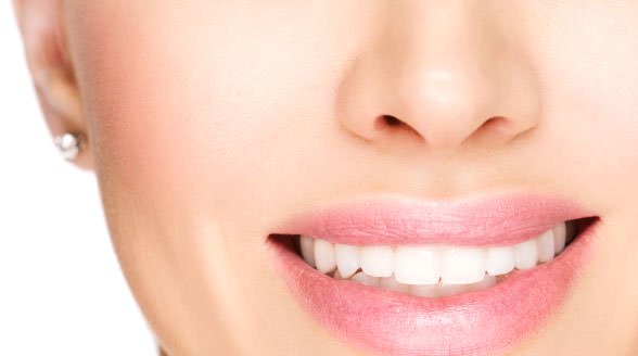 Porcelain Veneers and You