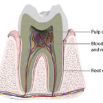 Root Canal Therapy is essential for preserving diseased teeth.