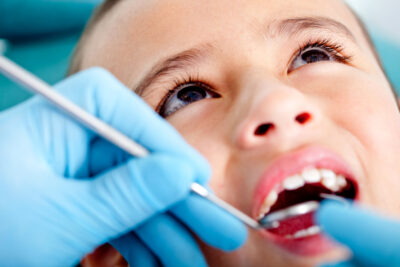 Pediatric Root Canal