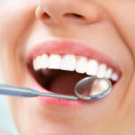 Advanced Tooth Whitening