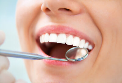 Advanced Tooth Whitening