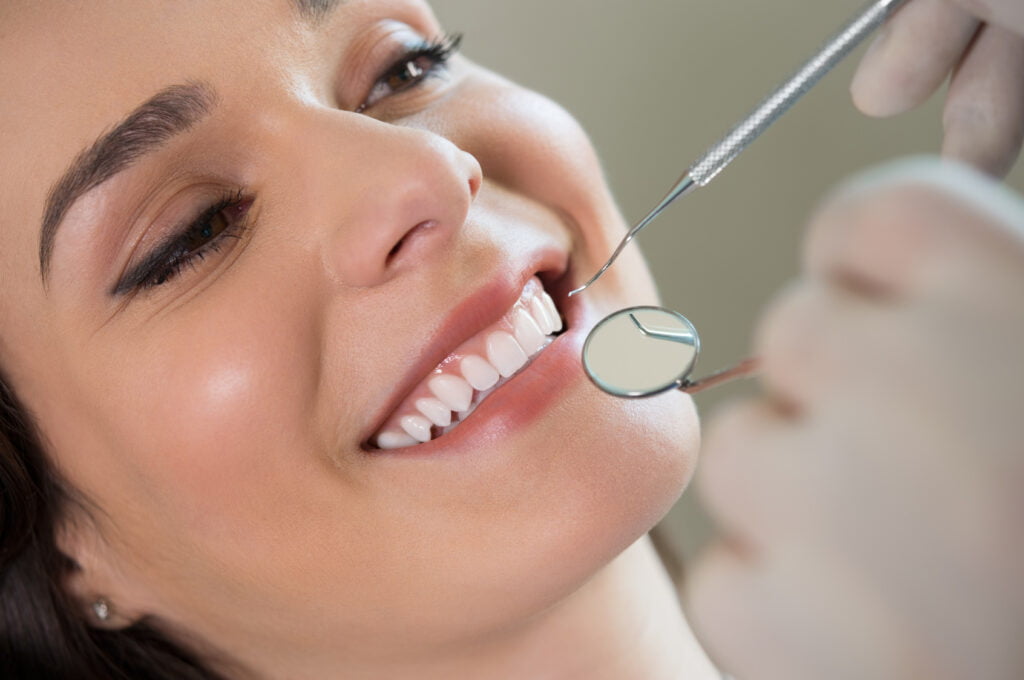 Myths About Veneers
