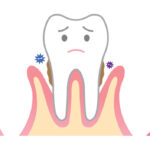 Gum Disease Description