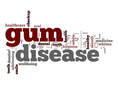 Gum Disease Prevention