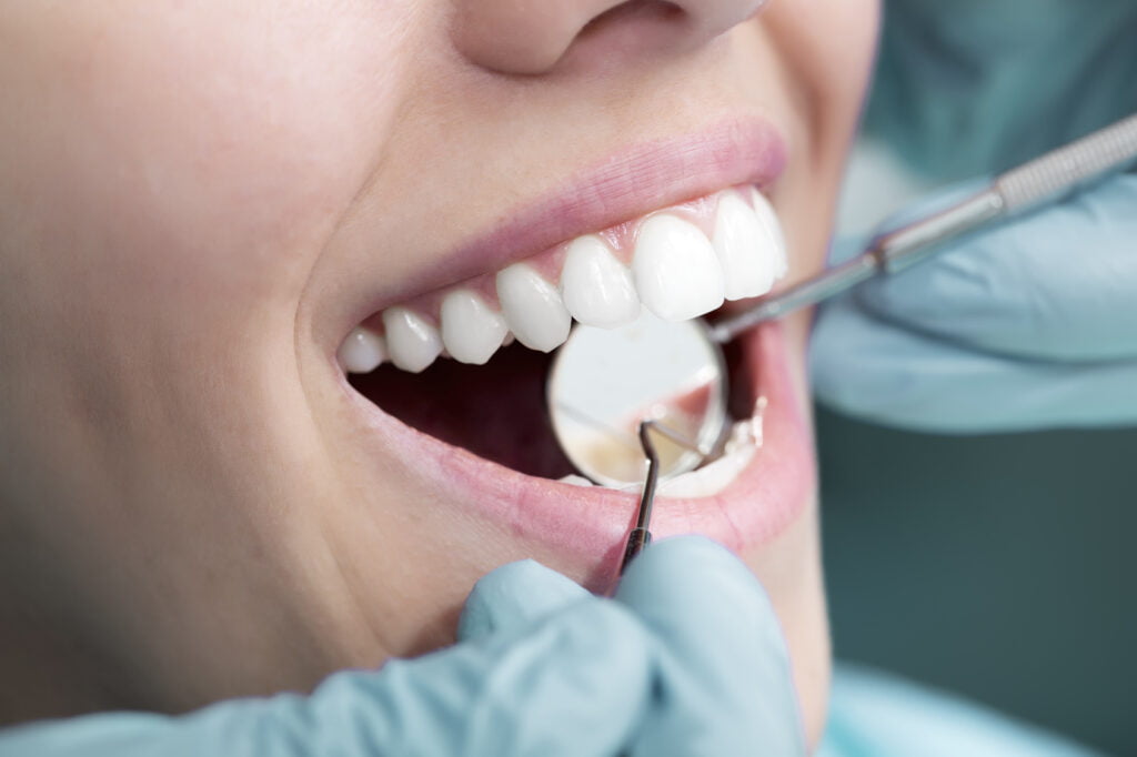 Invisalign Day at Yuba City Dentistry Group