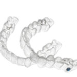 Invisalign teen aligners are designed to help teenagers use their orthodontics.