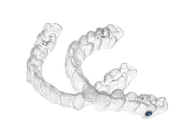 Amazing Results With Invisalign