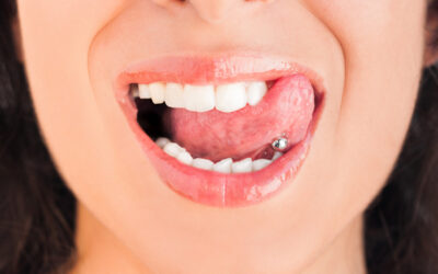 Oral Piercings and Dental Health
