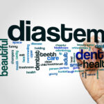 What is Diastema