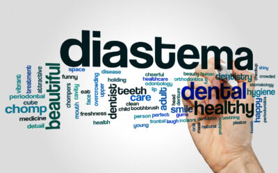 What is a Diastema?