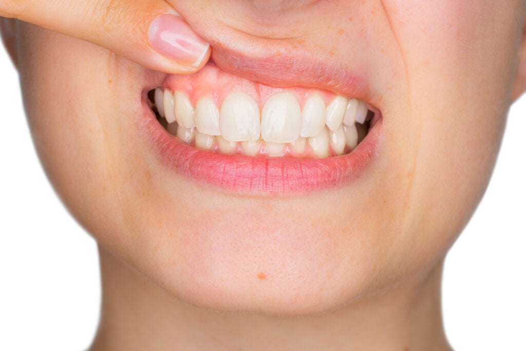 What is Pinhole Surgical Technique (PST)?