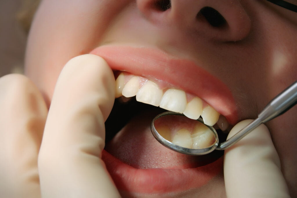 Detecting Gum Disease