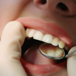 Detecting Gum Disease