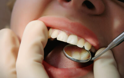Detecting Gum Disease