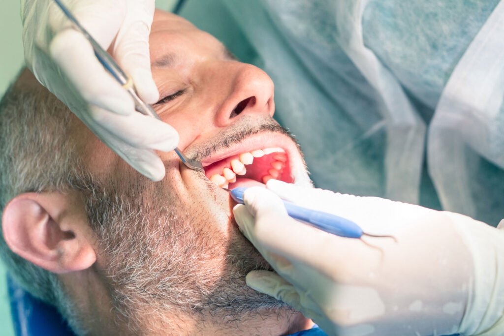 What is Debridement?