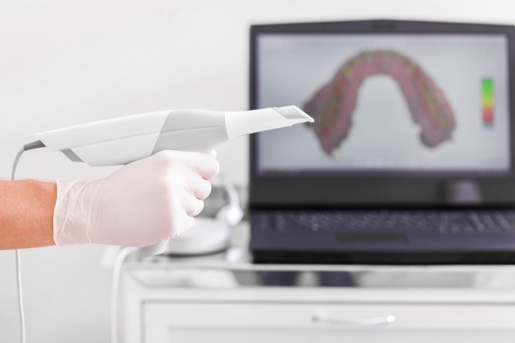 Invisalign – Let’s Do This!
