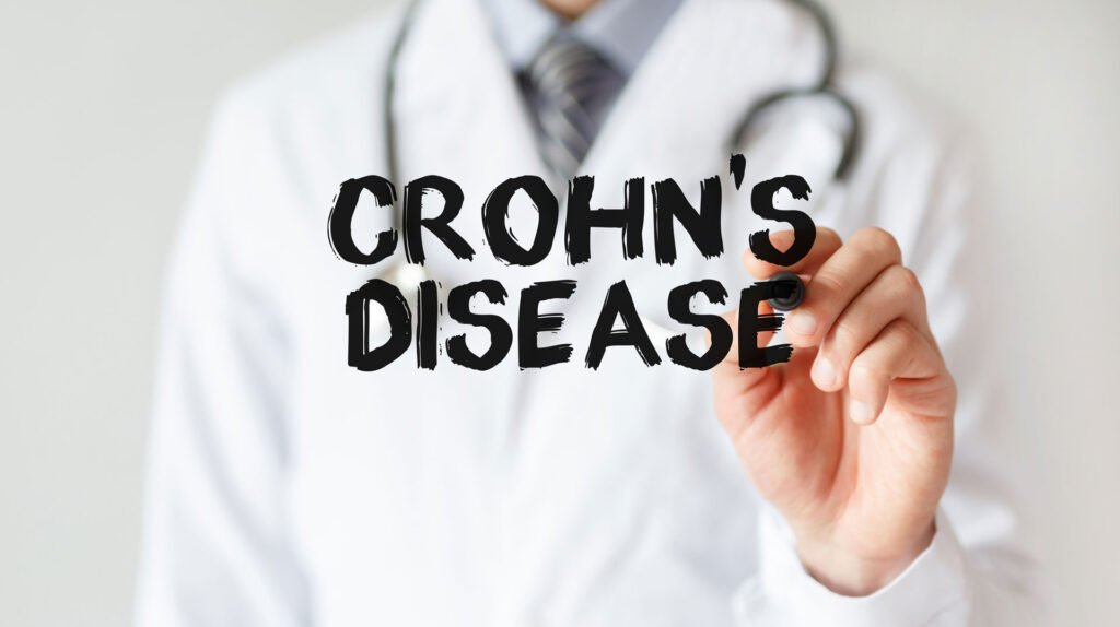 Maintain Oral Health Despite Crohn’s Disease