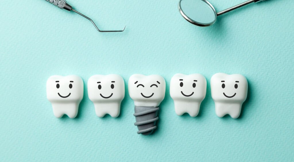 Experience Matters with Dental Implants