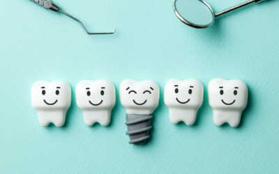 Experience Matters with Dental Implants