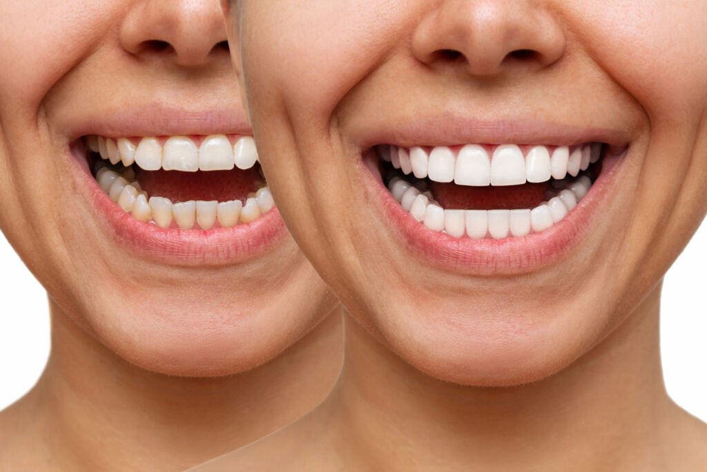What is Cosmetic Dentistry?