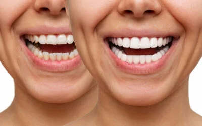 What is Cosmetic Dentistry?