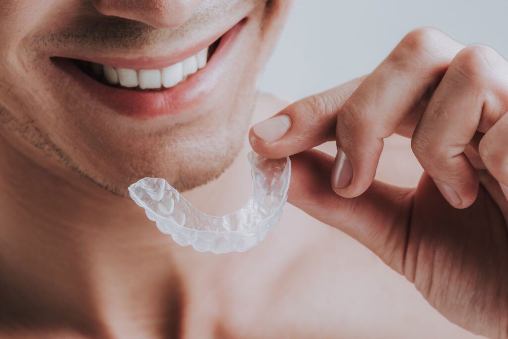 Mouthguards – Generic or Custom?