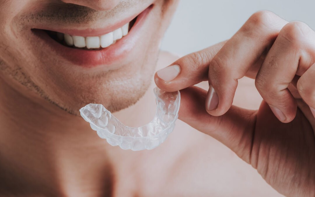 Mouthguards – Generic or Custom?