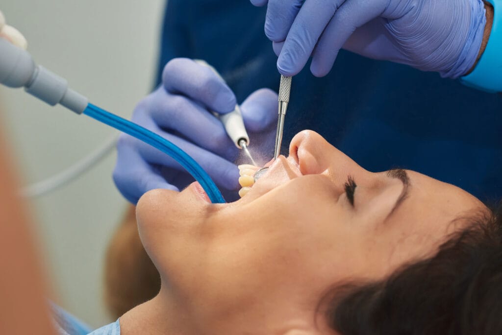 What is Dental Debridement?