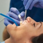 Close-up of a dental procedure with a patient lying back, mouth open. A dentist, wearing blue gloves, is using tools to clean the patient's teeth, including a dental scaler and a suction device with a blue tube. Water spray is visible as part of the cleaning process.