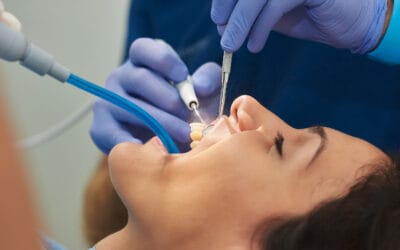 What is Dental Debridement?