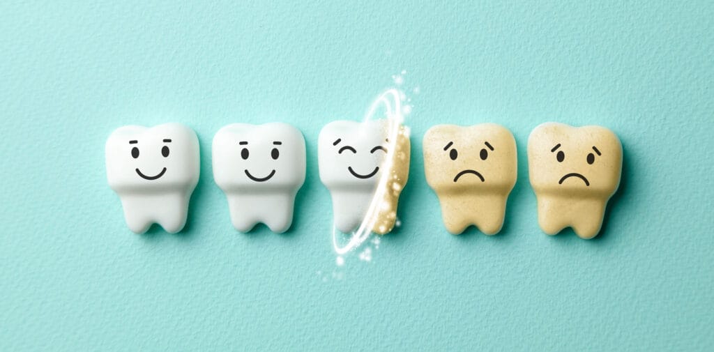 Brighten Your Smile Safely